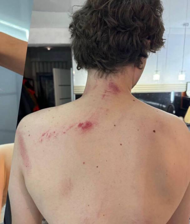 В Ставрополе конфликт между мужчинами в МКД закончился телесными повреждениями