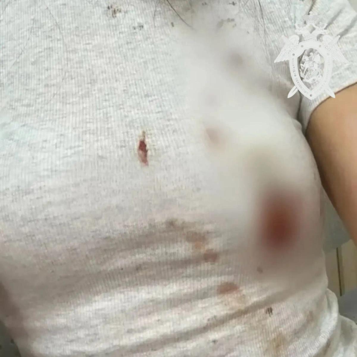 В Ессентуках проводят проверку по факту нападения бродячих собак на женщину