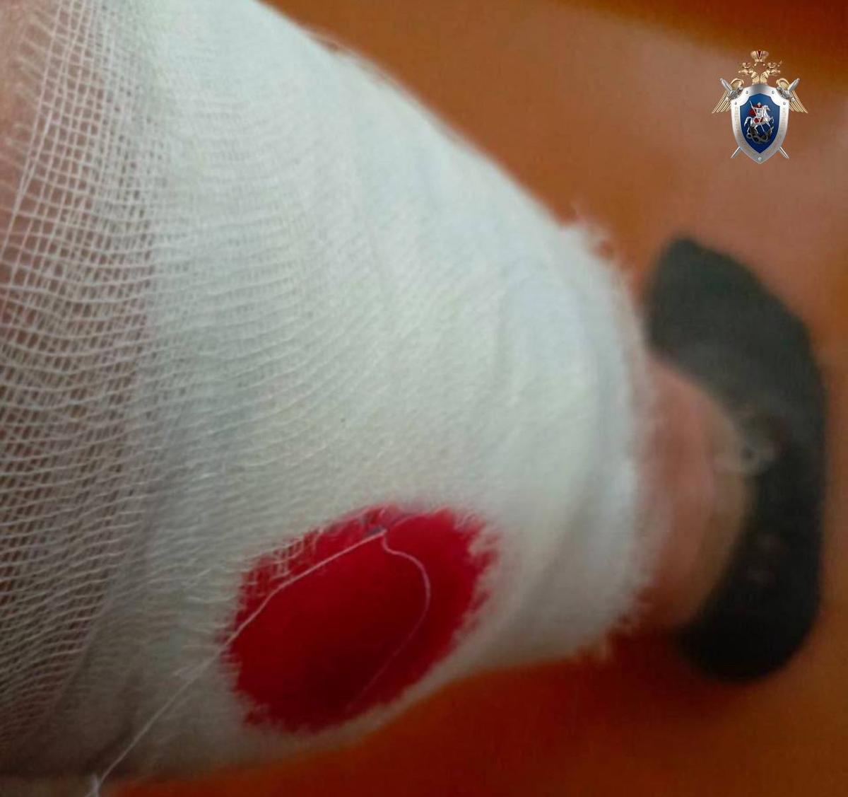 В Минводах на женщину напали агрессивные безнадзорные собаки