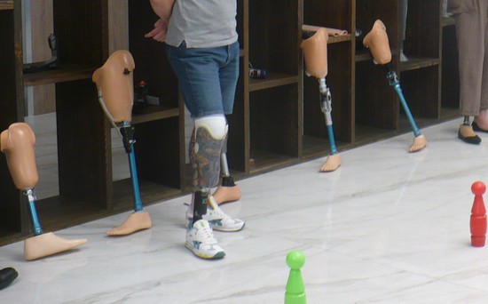 Технические средства реабилитации на коленный сустав